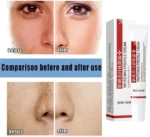 3pcs spot off freckle whitening cream