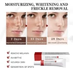 3pcs spot off freckle whitening cream