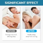 8 pcs anti snoring devices